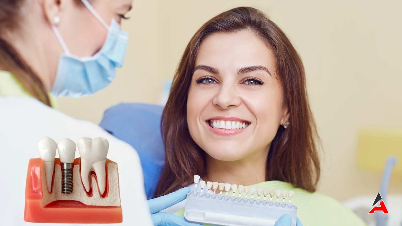 En İyi Diş İmplant Doktorları