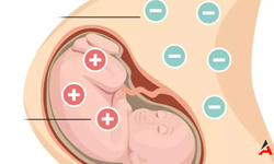 Bebek ve Anne Arasındaki Önemli Uyumsuzluk: Kan Uyuşmazlığı