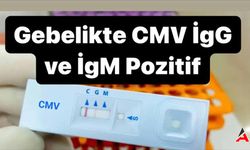 Anti-CMV IgG Pozitif: Ne Anlama Geliyor?