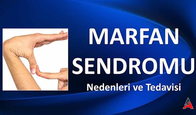 Marfan Sendromu Nedir: Belirtilere, Nedenlerine ve Tedavisine Bir Bakış