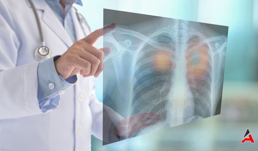Kadınlarda Akciğer Kanseri ve Artan Risk