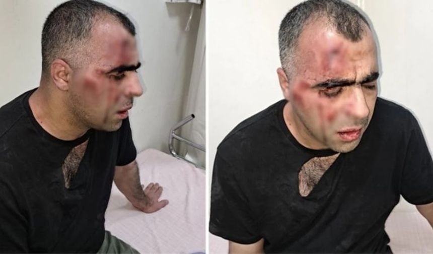 Gazeteci Sinan Aygül, Tatvan Belediyesi'ndeki Usulsüzlük İddialarını Gündeme Getirdiği İçin Saldırıya Uğradı